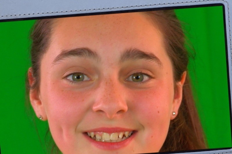 Idir Mise agus Tusa - Ard Mhacha vs Tír Chonaill